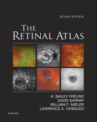 表紙画像: The Retinal Atlas 2nd edition 9780323287920