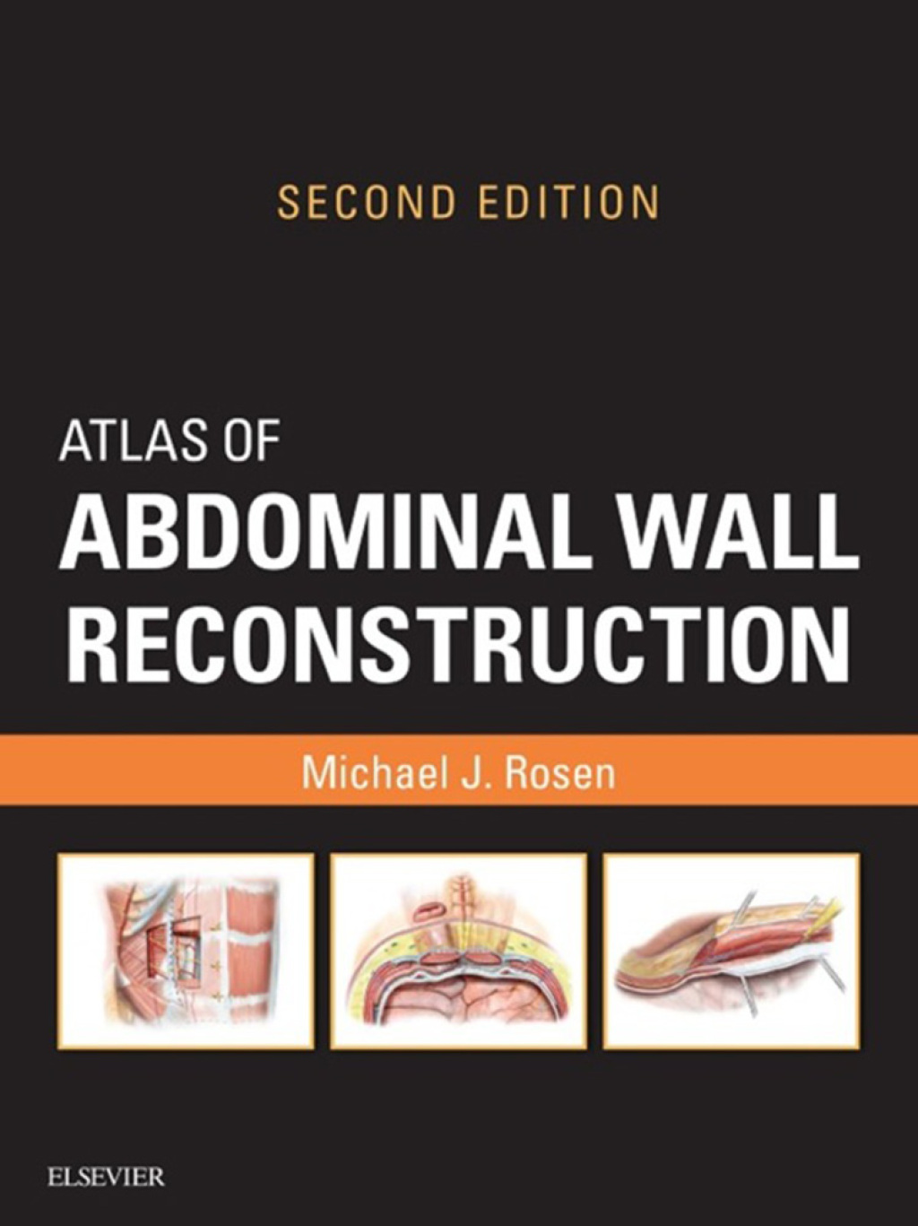 Atlas of Abdominal Wall Reconstruction 2nd Edition