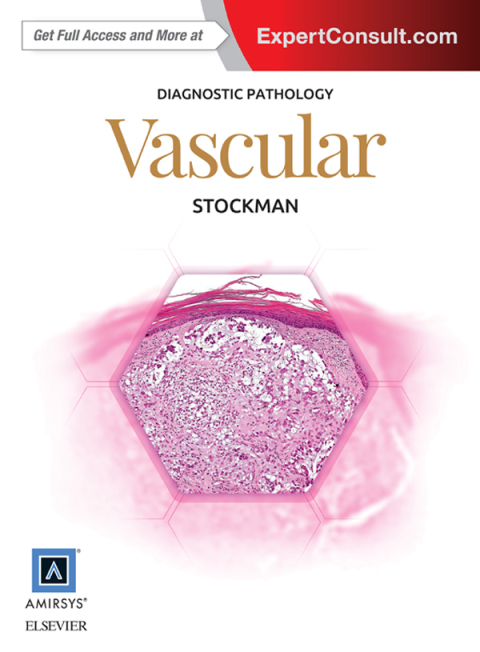 Diagnostic Pathology: Vascular - FULL INSTANT DOWNLOAD | PDF DOCX EPUB