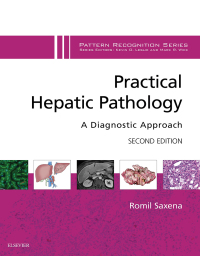 Titelbild: Practical Hepatic Pathology: A Diagnostic Approach 2nd edition 9780323428736