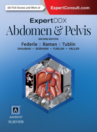 Imagen de portada: ExpertDDx: Abdomen and Pelvis E-Book 2nd edition 9780323442879