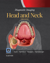 Cover image: Diagnostic Imaging: Head and Neck E-Book 3rd edition 9780323443012
