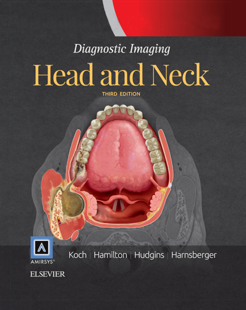 Diagnostic Imaging: Head and Neck E-Book, 3rd Edition - FULL INSTANT DOWNLOAD | PDF DOCX EPUB