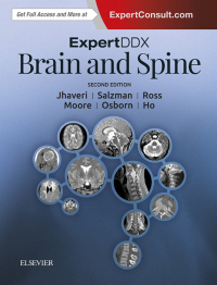 Immagine di copertina: ExpertDDx: Brain and Spine E-Book 2nd edition 9780323443081