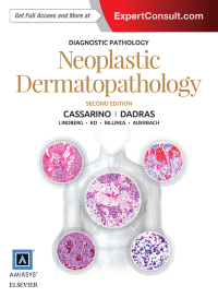 表紙画像: Diagnostic Pathology: Neoplastic Dermatopathology E-Book 2nd edition 9780323443104