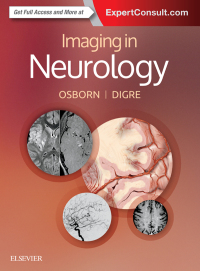Titelbild: Imaging in Neurology 9780323447812