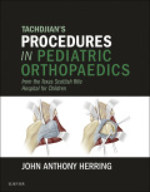 Tachdjian's Procedures in Pediatric Orthopaedics: From the Texas Scottish Rite Hospital for Children, 1st Edition - FULL INSTANT DOWNLOAD | PDF DOCX EPUB
