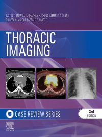 Cover image: Thoracic Imaging: Case Review Series 3rd edition 9780323428798