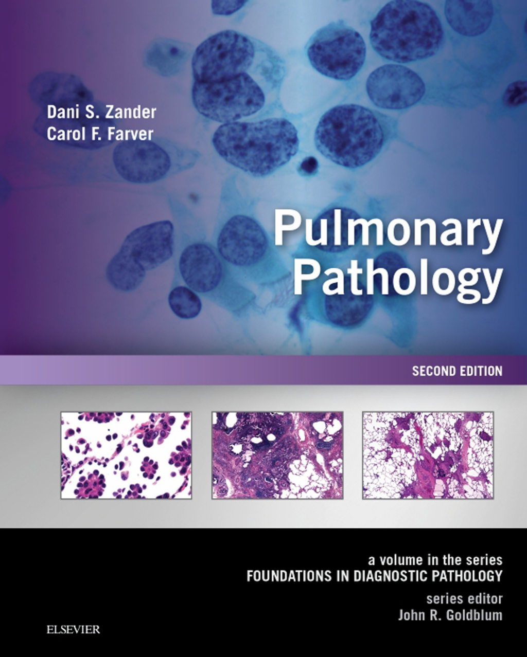 Pulmonary Pathology A Volume in the Series: Foundations in Diagnostic Pathology 2nd Edition
    Newer Edition Available
