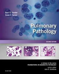 Titelbild: Pulmonary Pathology 2nd edition 9780323393089