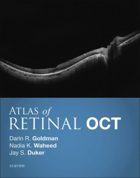 Titelbild: Atlas of Retinal OCT: Optical Coherence Tomography 9780323461214