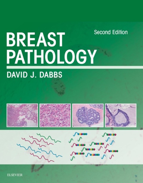 Breast Pathology, 2nd  Edition - FULL INSTANT DOWNLOAD | PDF DOCX EPUB