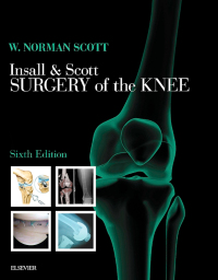 Cover image: Insall & Scott Surgery of the Knee 6th edition 9780323400466