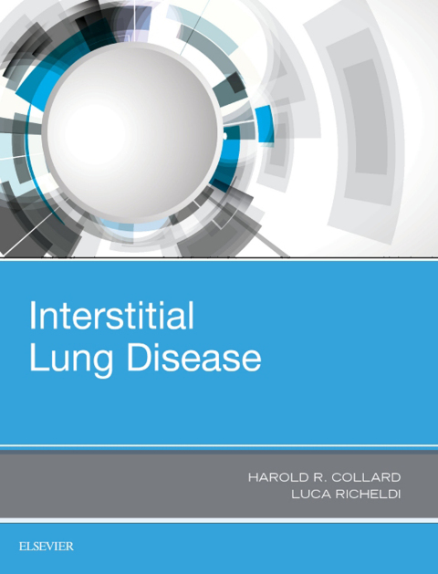 Interstitial Lung Disease, 1st Edition - FULL INSTANT DOWNLOAD | PDF DOCX EPUB
