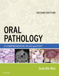 Cover image: Oral Pathology 2nd edition 9780323390545