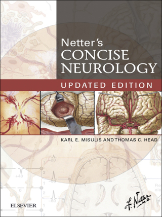 Imagen de portada: Netter's Concise Neurology Updated Edition 1st edition 9780323482547