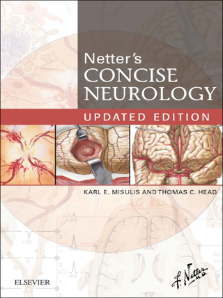 Cover image: Netter's Concise Neurology Updated Edition 9780323482547