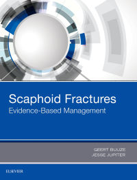 Cover image: Scaphoid Fractures 9780323485647