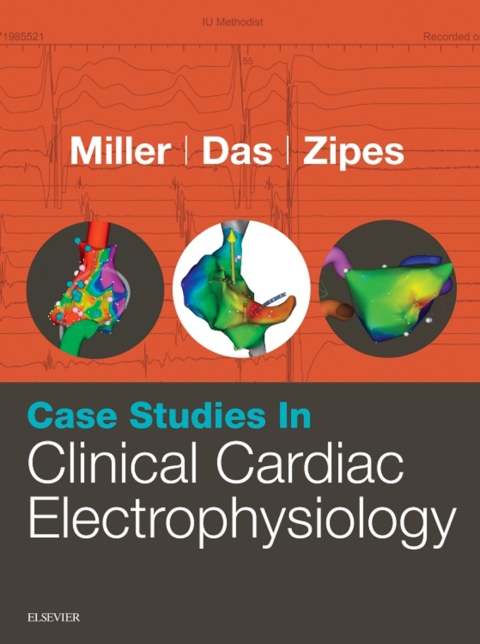 Case Studies in Clinical Cardiac Electrophysiology, 1st Edition - FULL INSTANT DOWNLOAD | PDF DOCX EPUB