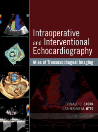 Cover image: Intraoperative and Interventional Echocardiography 2nd edition 9780323358255