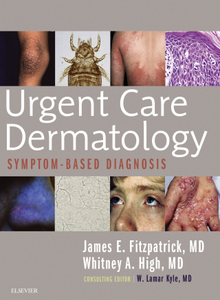 表紙画像: Urgent Care Dermatology: Symptom-Based Diagnosis 1st edition 9780323485531