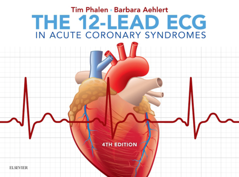 The 12-Lead ECG in Acute Coronary Syndromes, 4th Edition - FULL INSTANT DOWNLOAD | PDF DOCX EPUB