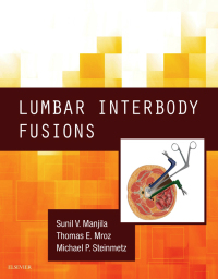 Cover image: Lumbar Interbody Fusions 9780323476638
