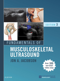 Cover image: Fundamentals of Musculoskeletal Ultrasound 3rd edition 9780323445252