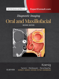 Cover image: Diagnostic Imaging: Oral and Maxillofacial E-Book 2nd edition 9780323477826