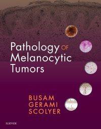 Cover image: Pathology of Melanocytic Tumors 9780323374576