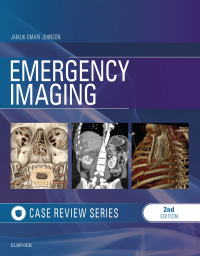 Immagine di copertina: Emergency Imaging: Case Review 2nd edition 9780323428750