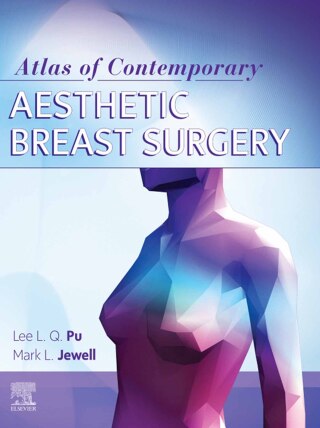 Cover image: Atlas of Contemporary Aesthetic Breast Surgery 1st edition 9780323511131