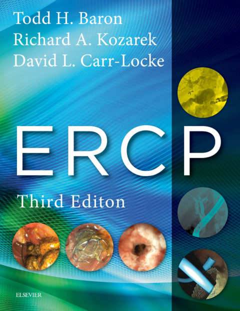 ERCP, 3rd Edition - FULL INSTANT DOWNLOAD | PDF DOCX EPUB