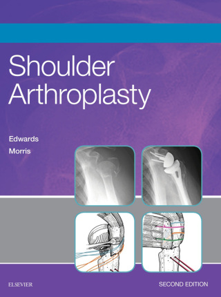 Cover image: Shoulder Arthroplasty 2nd edition 9780323529402