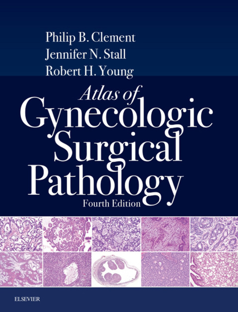 Atlas of Gynecologic Surgical Pathology E-Book, 4th Edition - FULL INSTANT DOWNLOAD | PDF DOCX EPUB