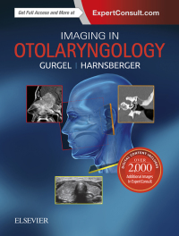 表紙画像: Imaging in Otolaryngology 9780323545082