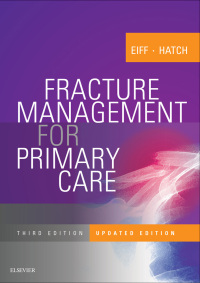 Imagen de portada: Fracture Management for Primary Care Updated Edition - Electronic 3rd edition 9780323546553