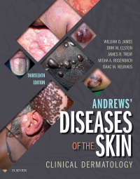 صورة الغلاف: Andrews' Diseases of the Skin 13th edition 9780323547536