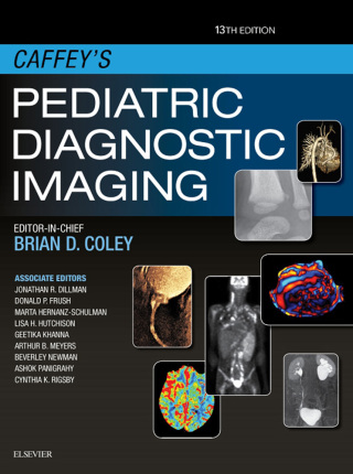 Imagen de portada: Caffey's Pediatric Diagnostic Imaging 13th edition 9780323497480