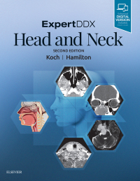 表紙画像: ExpertDDX: Head and Neck 2nd edition 9780323554053