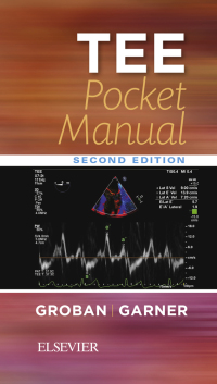 صورة الغلاف: TEE Pocket Manual 2nd edition 9780323522809