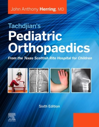 Cover image: Tachdjian's Pediatric Orthopaedics: From the Texas Scottish Rite Hospital for Children 6th edition 9780323567695
