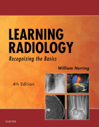 Cover image: Learning Radiology 4th edition 9780323567299