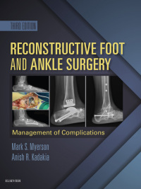 Cover image: Reconstructive Foot and Ankle Surgery: Management of Complications 3rd edition 9780323496933