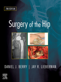 Imagen de portada: Surgery of the Hip 2nd edition 9780323554640