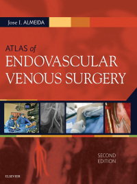 表紙画像: Atlas of Endovascular Venous Surgery 2nd edition 9780323511391
