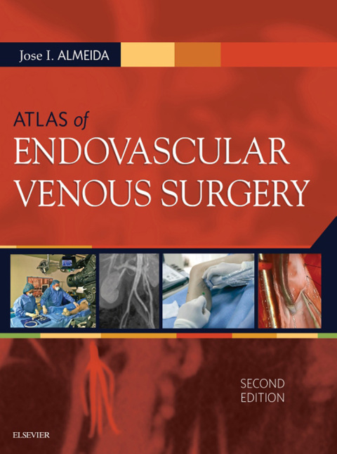 Atlas of Endovascular Venous Surgery, 2nd Edition - FULL INSTANT DOWNLOAD | PDF DOCX EPUB