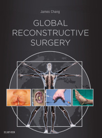 Immagine di copertina: Global Reconstructive Surgery 9780323523776
