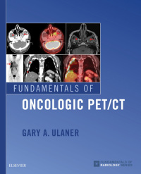 Imagen de portada: Fundamentals of Oncologic PET/CT 9780323568692