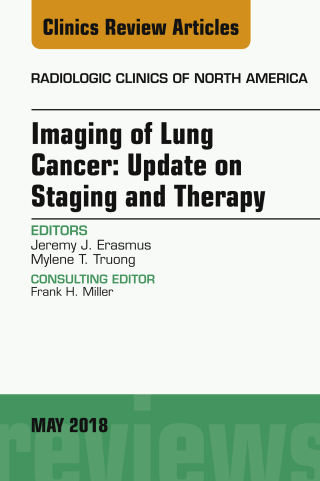 Immagine di copertina: Lung Cancer, An Issue of Radiologic Clinics of North America 9780323583749